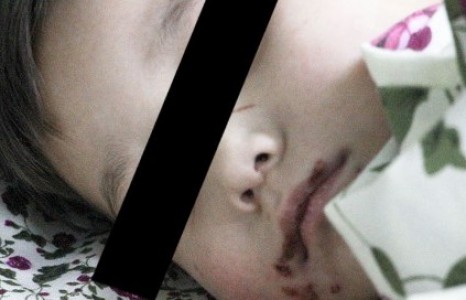 Дагавар хүүгээ сэхээнд ортол зодсон эцгийг хорьжээ