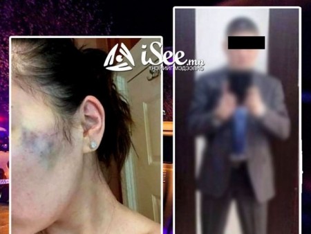 News paparazzi : 27 настай бүсгүйг зодсон байж болзошгүй гэж н.Батхүүг шалгаж байгаа юу...