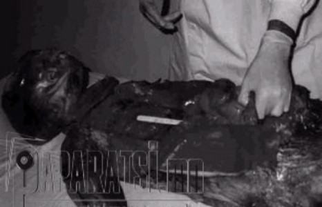 Харийн хүнийг задлан шинжлэв