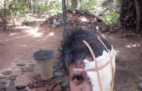 Шархаа эдгээлгүй нүүрээ алджээ