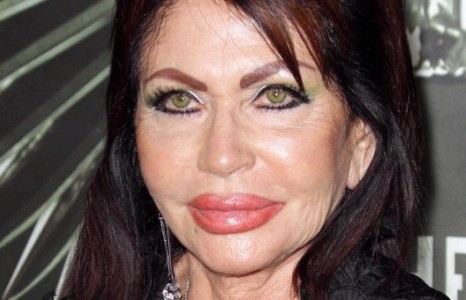  Сильвестр Сталлонегийн ээж “зузаан” уруулаараа голливудынхныг гайхшируулжээ