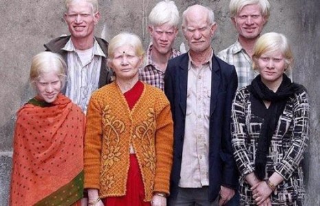 Энэтхэгийн альбинос гэр бүл /фото/