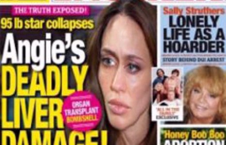 А.Жолигийн өвчин эцсийн шатандаа оржээ