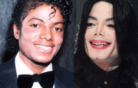 Амжилтгүй болсон гоо сайхны мэс заслууд