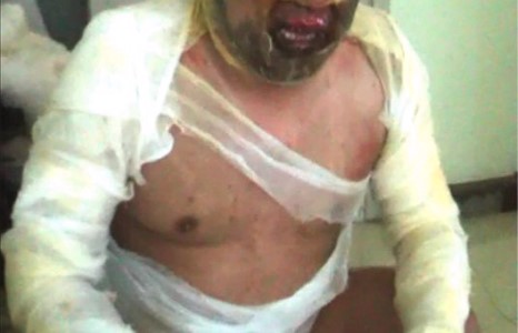 Амьдаараа галд шатсан Баавар [ВИДЕО]