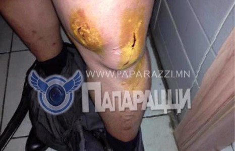 “Голомт” банк харилцагчийнхаа эрүүл мэндийг хохиролоо 