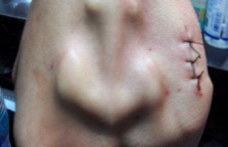 Гарын чимэглэл