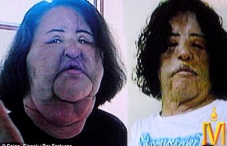 Гоо сайхны хагалгаанд хэт донтох ийм л аюултай