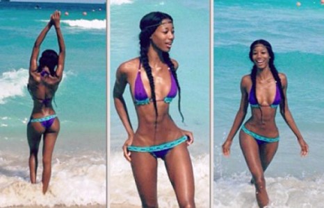 Олигархи Дорониний найз бүсгүй хавиргаа авахуулжээ