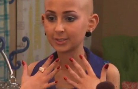 Нүүр будалтаараа дэлхийд танигдсан бяцхан охин нас барлаа