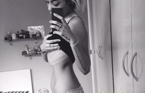 Хоолны дэглэм барих гэж хэтрүүлж байгаад ийм болуузай