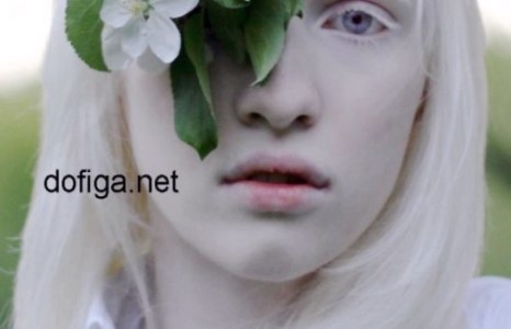 Альбинос Настя