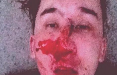 “Ажнай”-н хүү Б.Билгүүн хэнээс ухамсрын шанаа хүртэв?