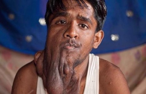 Гаж төрхнөөсөө салсан залуу эхнэр хайж байна 