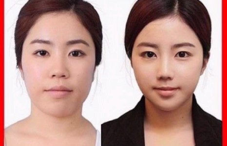 Солонгост хийгдсэн хамгийн амжилттай болсон пластик мэс заслууд /фото/ 