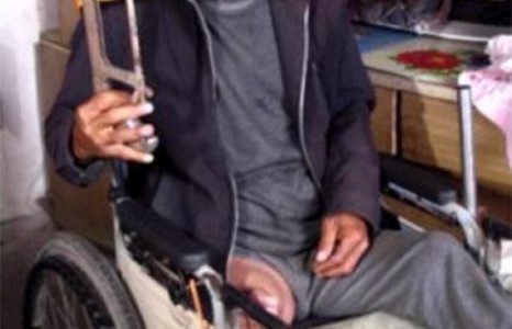 Хагалгааны мөнгөгүйн улмаас өөрийнхөө хөлийг тайрчээ