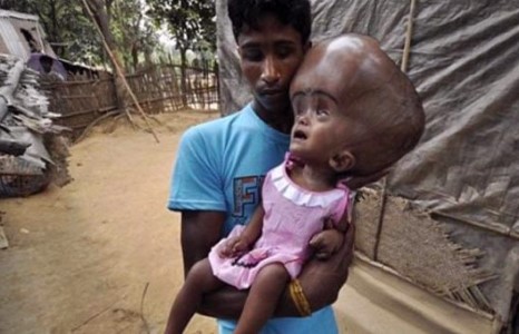 94 см толгойтой охины тархинаас шингэнийг авч, 58 см болгожээ