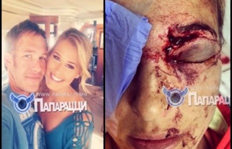 АНУ-ын үнэмлэхүй аварга Сэмюэл Боде Миллер эхнэрээ хүнд гэмтээв (фото)