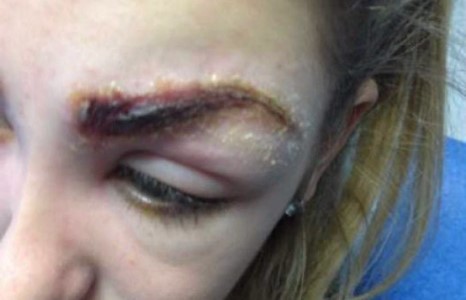 Хөмсгөө шивүүлж, гоё болох гэсэн 17-той охин мангас болон хувирчээ