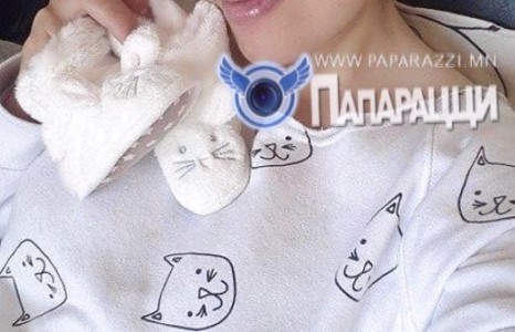 Дуучин Нара хөл хүнд үеийнхээ зургийг анх удаа дэлгэлээ