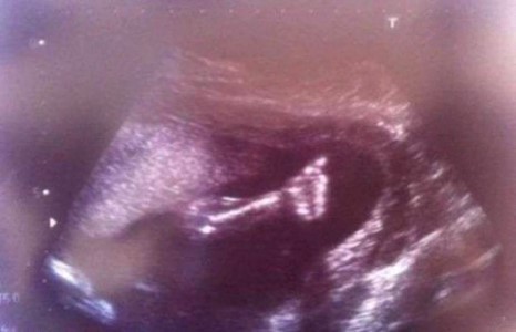 Жинхэнэ гайхамшиг