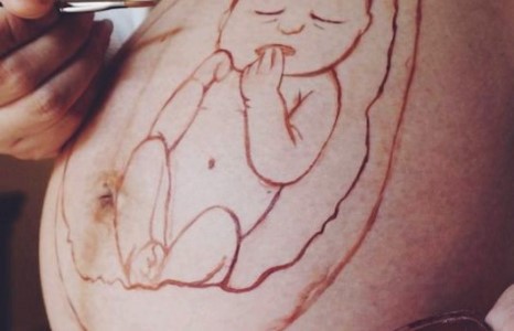 Өвөрмөц урлаг