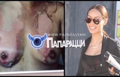 Жүжигчин Алдармаагийн тарьсан балаг