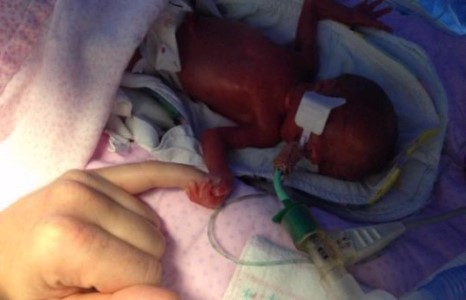 16 долоо хоногтойдоо гарсан охины түүх