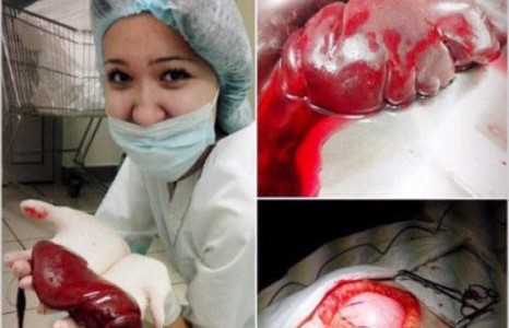 Анагаахын оюутан задлан хийж байхдаа селфиджээ