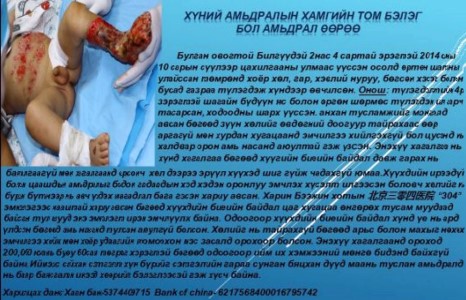 Б.Билгүүдэй хүүд туслацгаая