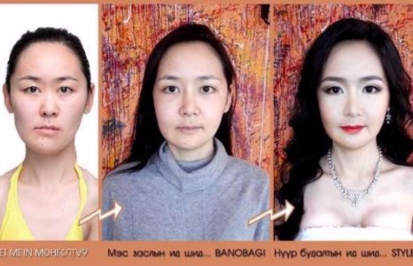 “Монгол Let me in” нэвтрүүлгийн ялагч С.Чимэгсайханы өөрчлөлт