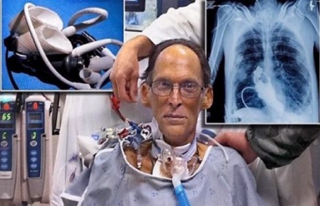 Дэлхийн хамгийн анхны зүрхгүй хүн