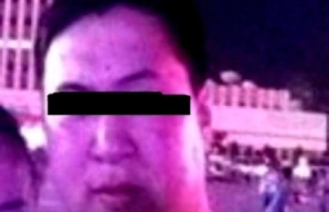 Эмэгтэйг зэрэмдэглэсэн этгээд “харилцан зодоон болсон” гэж мэдүүлжээ