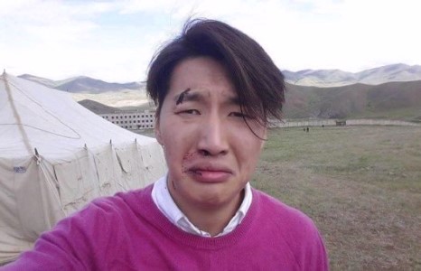 Загвар өмсөгч Э.Энхболд хүнд зодуулжээ