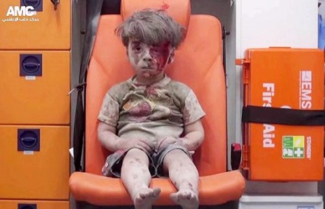 Омран хүүгийн зураг дэлхий нийтийг эмзэглүүлж байна