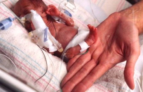 Манай гаригийн хамгийн бяцхан жаал 226 грамм, 22 см төрсөн