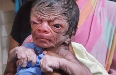 Бангладешд Бэнжамин Баттон төрлөө