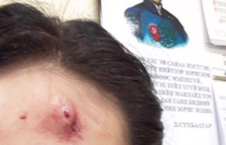 Сүхбаатар дүүргийн МАН-ынхан согтуугаар зодолдож нэгнийгээ гэмтээсэн үү...