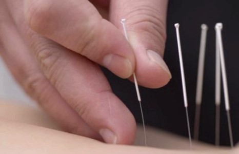 Манайх хамгийн сайн уламжлалт эмчилгээтэй 