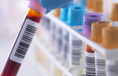 Хорт хавдрыг эмчлэх туршилт 75 хувийн амжилттай болов