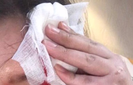 “Зуун наст” эмийн сангийн ажилтан хэрэглэгч рүүгээ эм шидэж бэртээжээ  