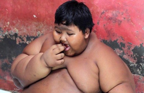 Дэлхийн хамгийн тарган хүүхэд “жингээ хаяна”