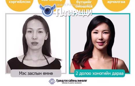 Нүцгэлэх дуртай миссийн нүүрээ янзлуулсны дараах өөрчлөлт