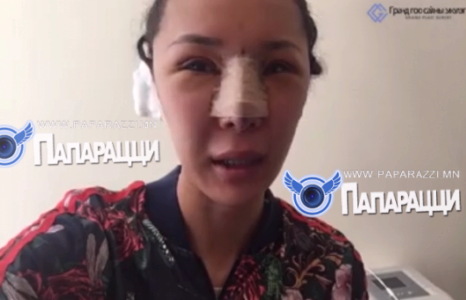 Мисс Сэлэнгэ: Миний нүүр хавдартай байна  