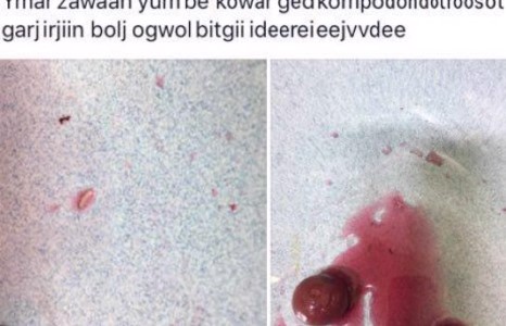 “Баясах трэйд” ХХК-ийн оруулж ирдэг “Kowar” компотноос  дахин өт гарлаа гэв