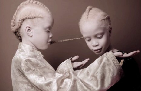 Бразилийн албино ихрүүд загварын ертөнцөд тэсрэлт хийж байна