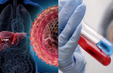 Элэгний В, С вирусийн илрүүлэг шинжилгээ маргааш эхэлнэ