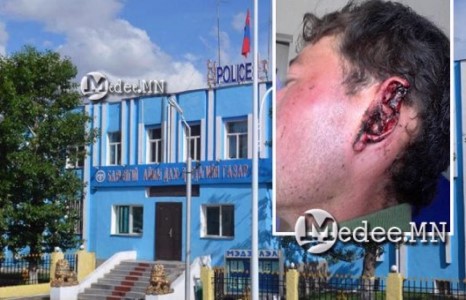 Сонгуулиар МАН-ыг дэмжээгүй иргэнийг бүлэглэн зодож, чихийг нь тас хазжээ