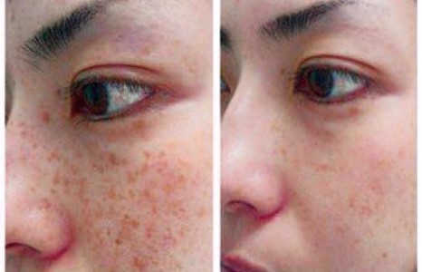 Арьсандаа тохирсон чанартай цогц үйлчилгээг хайж явах шаардлагагүй боллоо