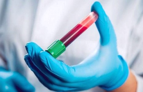 230 мянган хүний 17,5 хувь нь В, С вирүсээр халдварлажээ